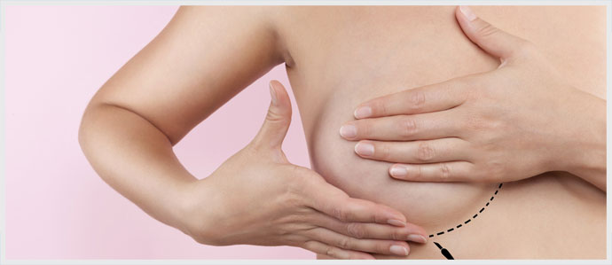 Woman Having Breast Augmentation Operation
