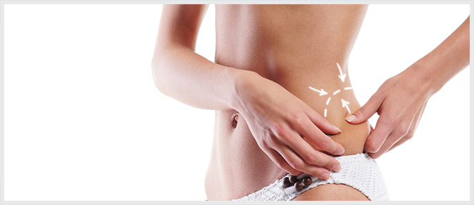 Tummy Tuck Plastic Surgery Lines