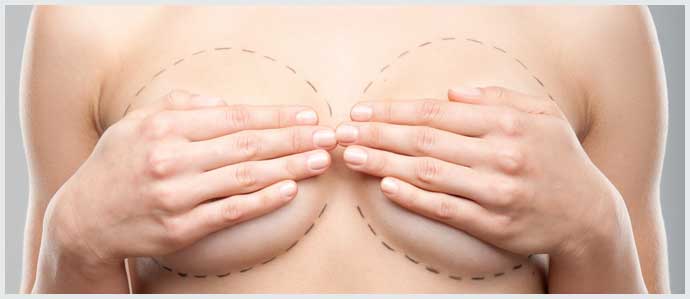 Woman with Breast Reduction Surgery