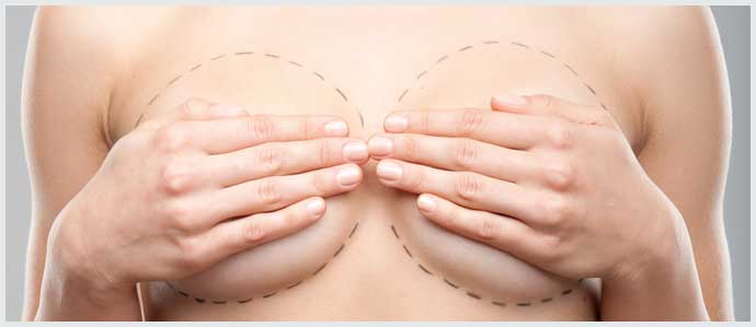 Breast Reduction - Phoenix Plastic Surgery