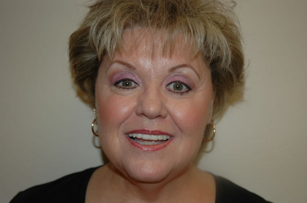 Eyelid Lift
