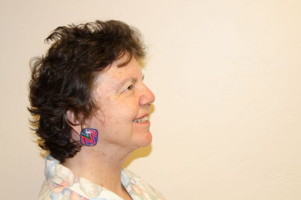 26-facelift-neck-lift-4